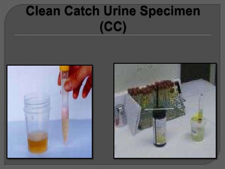 clean catch urine instructions poster